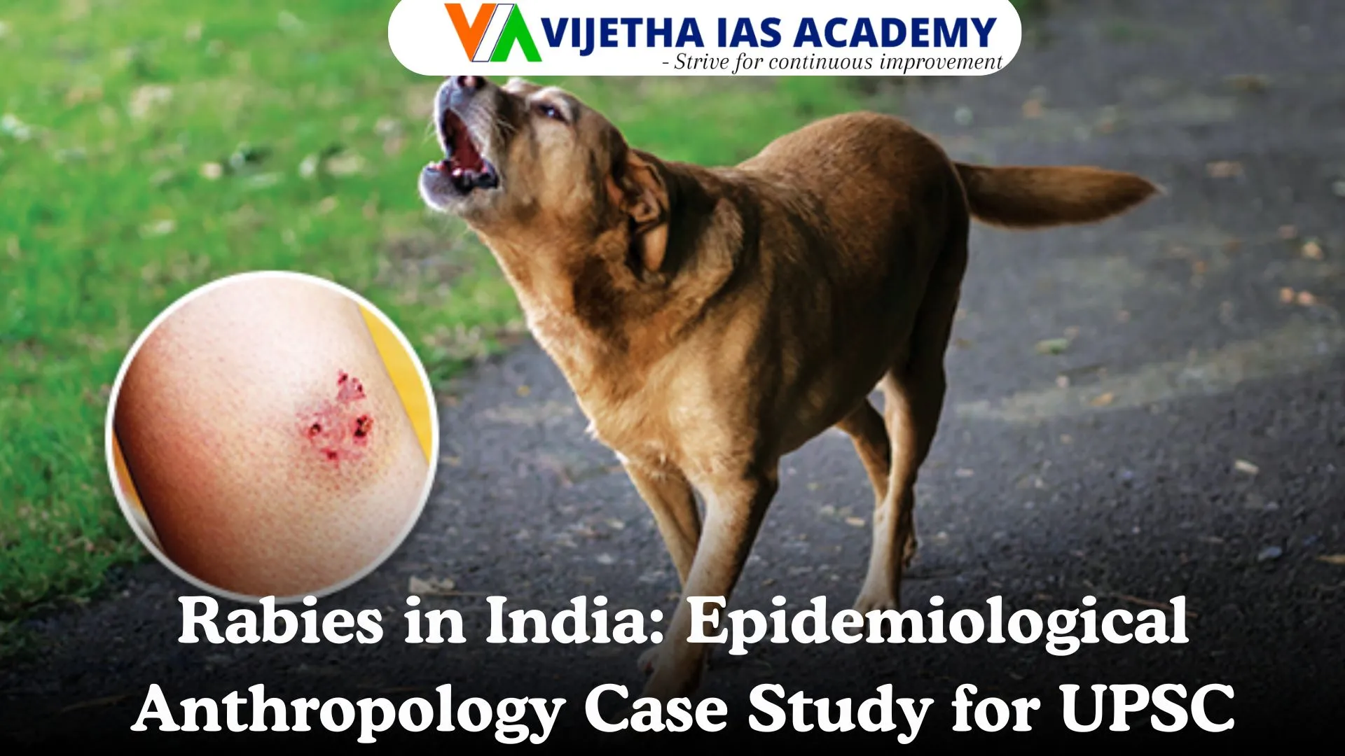 Rabies in India: An Anthropological Case Study