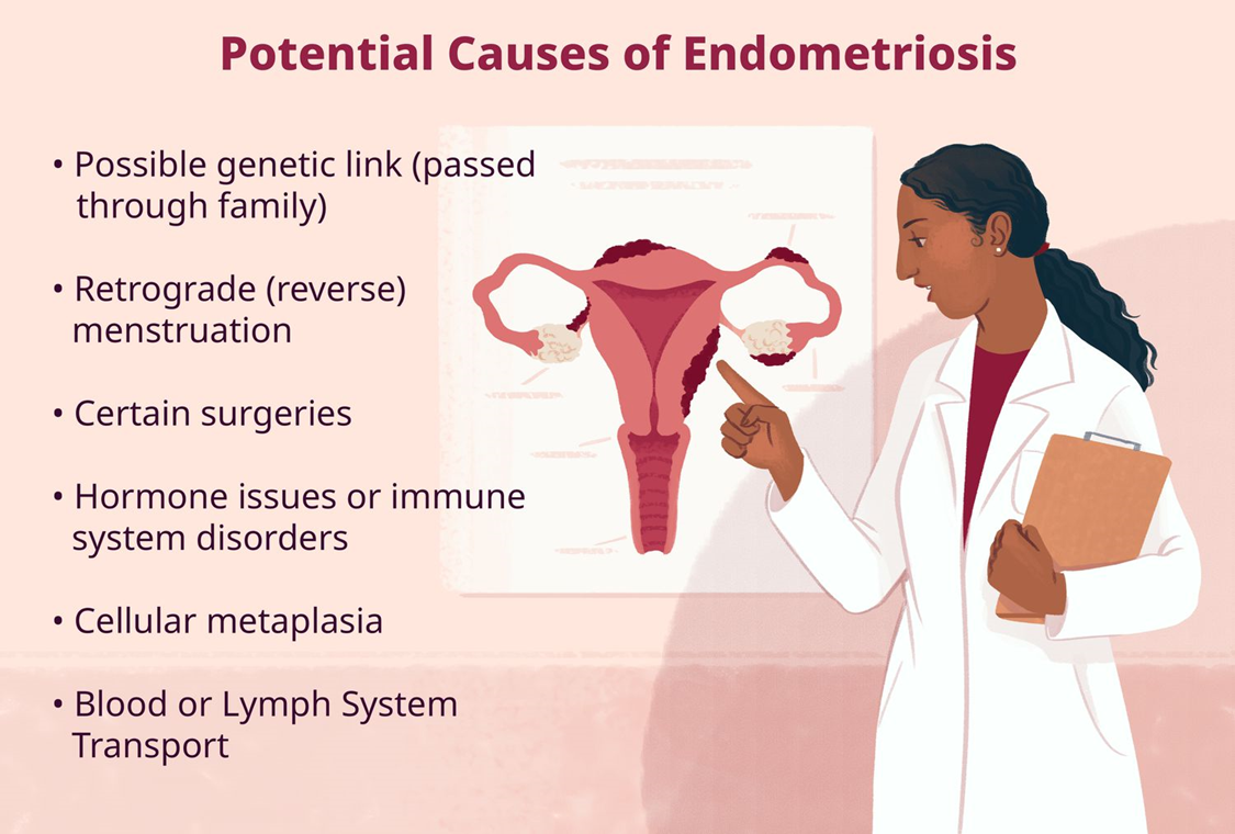 ENDOMETRIOSIS L2A Learn to Achieve