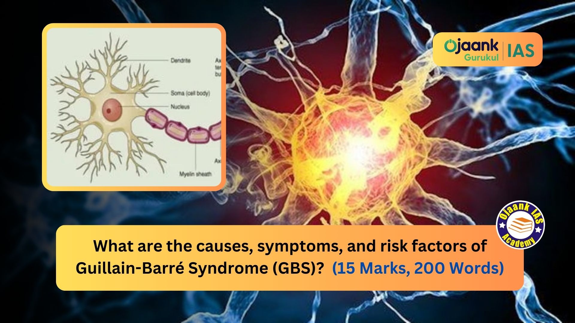 img-What are the causes, symptoms, and risk factors of Guillain-Barré Syndrome (GBS)? (15 Marks, 200 Words)