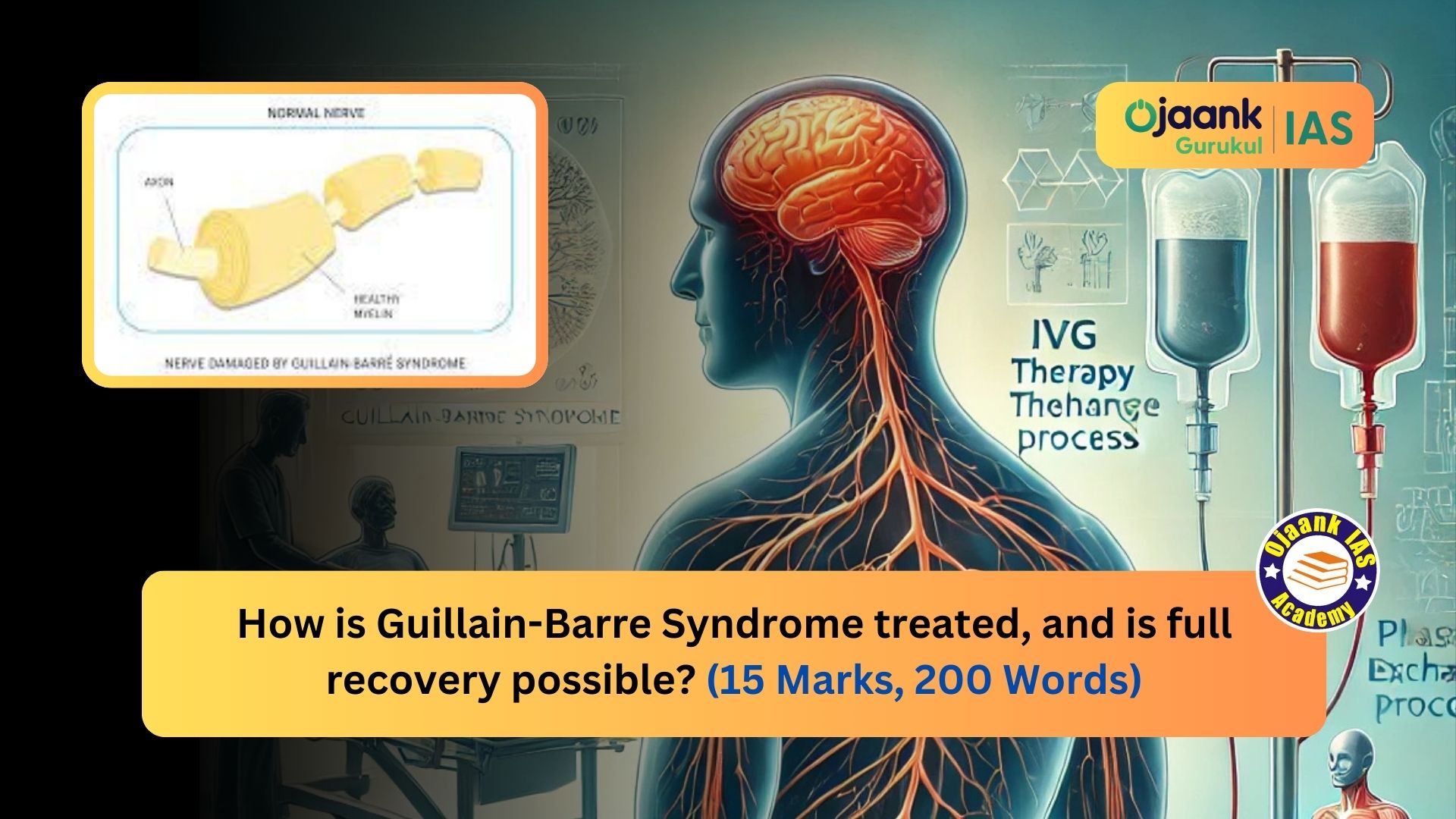 img-How is Guillain-Barre Syndrome treated, and is full recovery possible? (15 Marks, 200 Words)