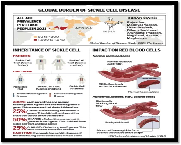 img-Gene therapy for treating Sickle Cell Disease