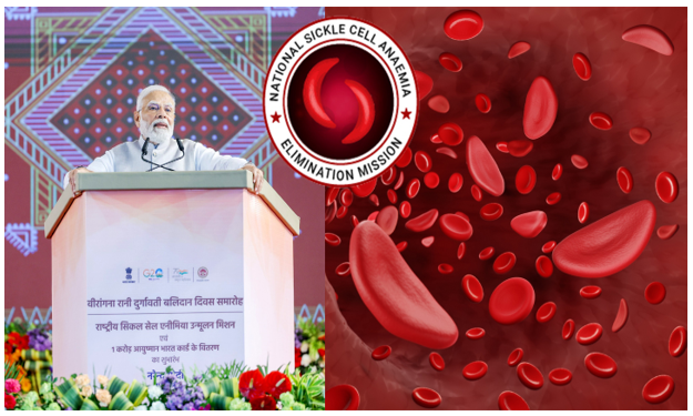 img-National Sickle Cell Anaemia Elimination Mission