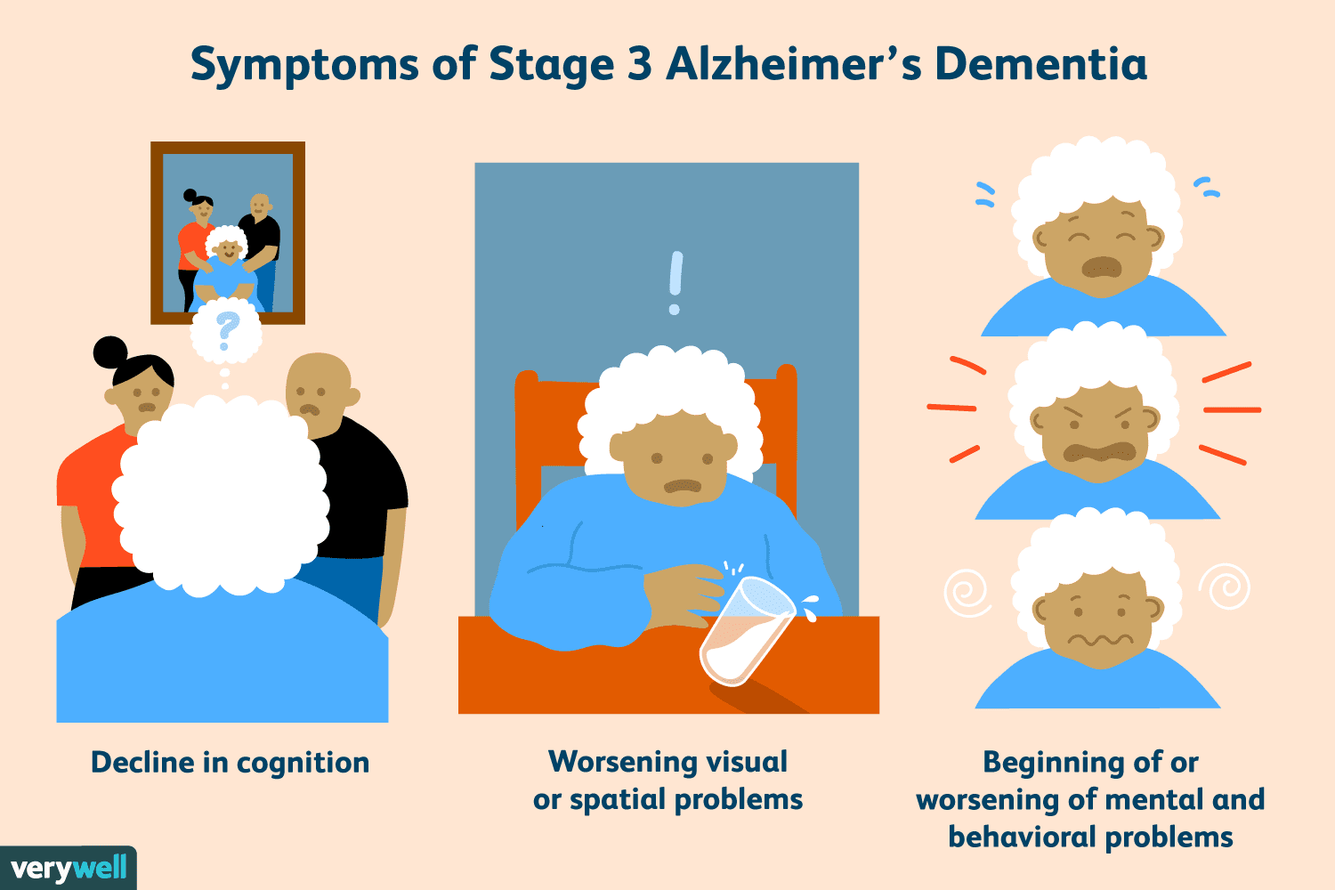 img-Lecanemab: New Alzheimer’s Drug